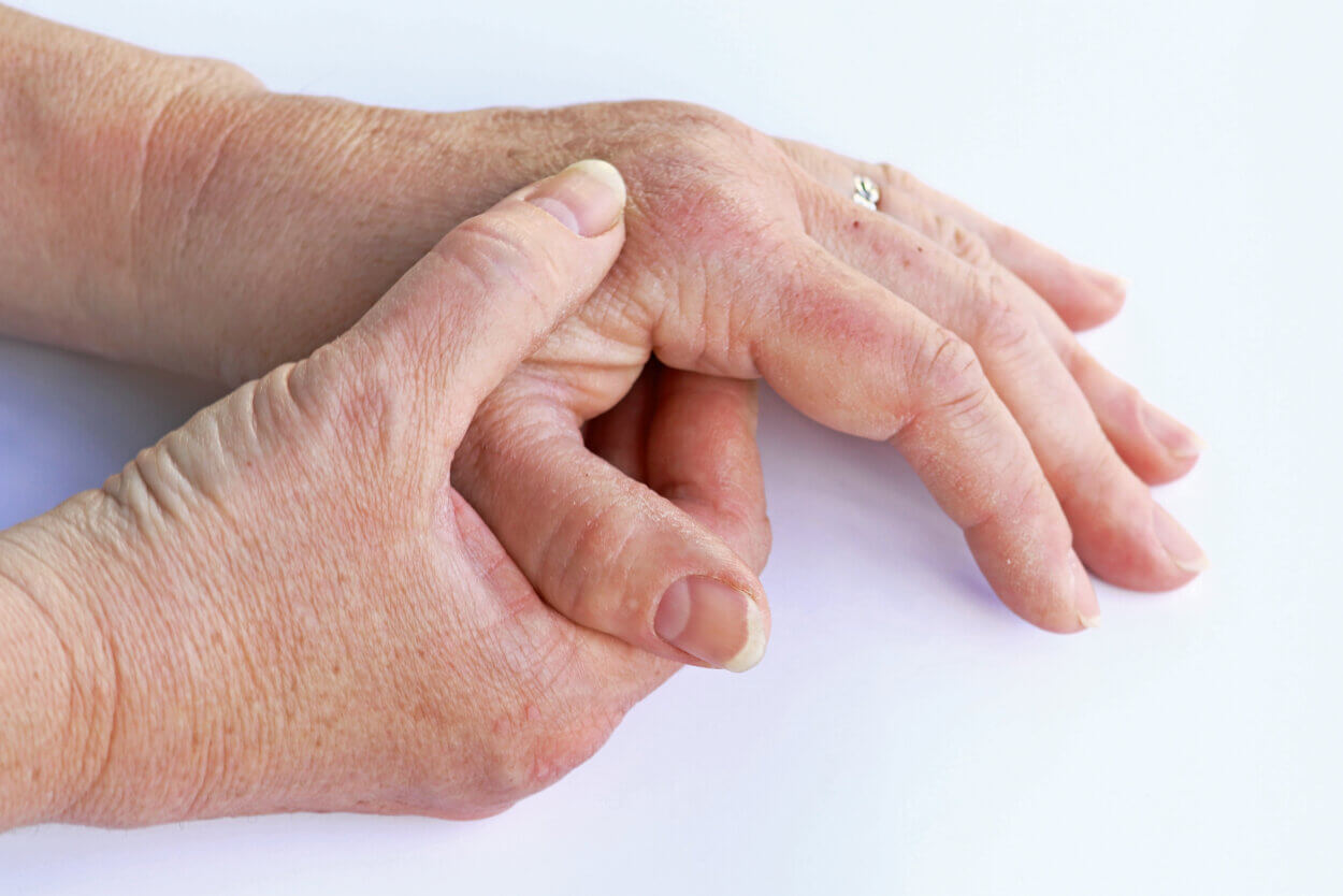 Arthrose