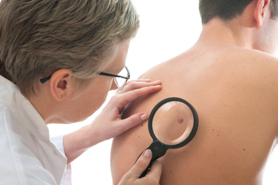 Melonom Diagnose