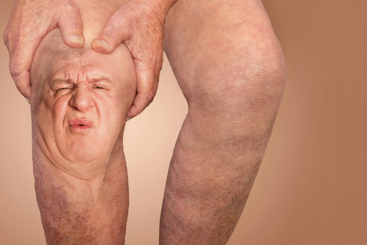 Ein bakterieller Gelenkerguss ist schmerzhaft