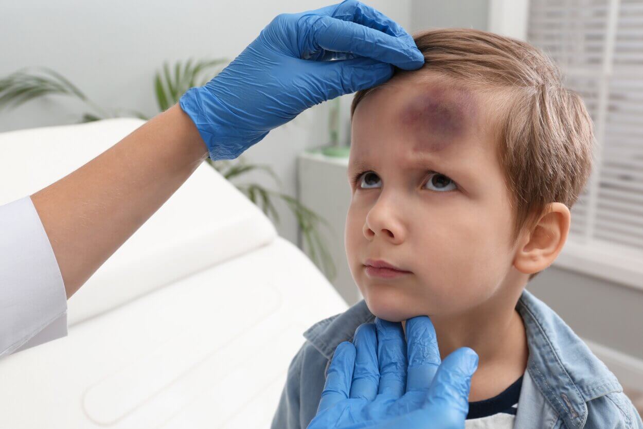 Arzt überprüft die Stirn eines Jungen mit Bluterguss