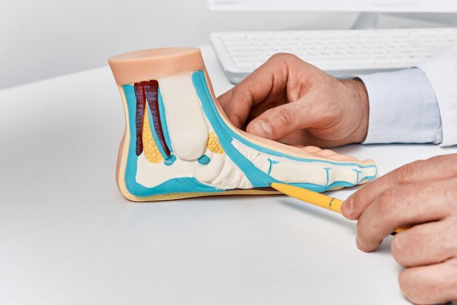 Anatomisches flaches Fußmodell