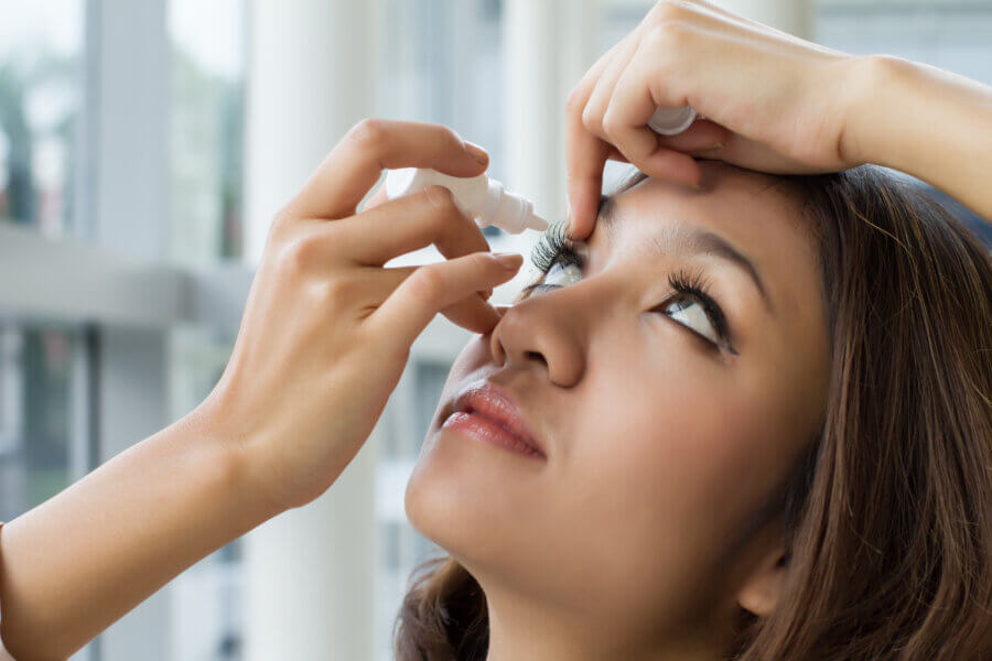 Trockene Augen bei Sjögren-Syndrom