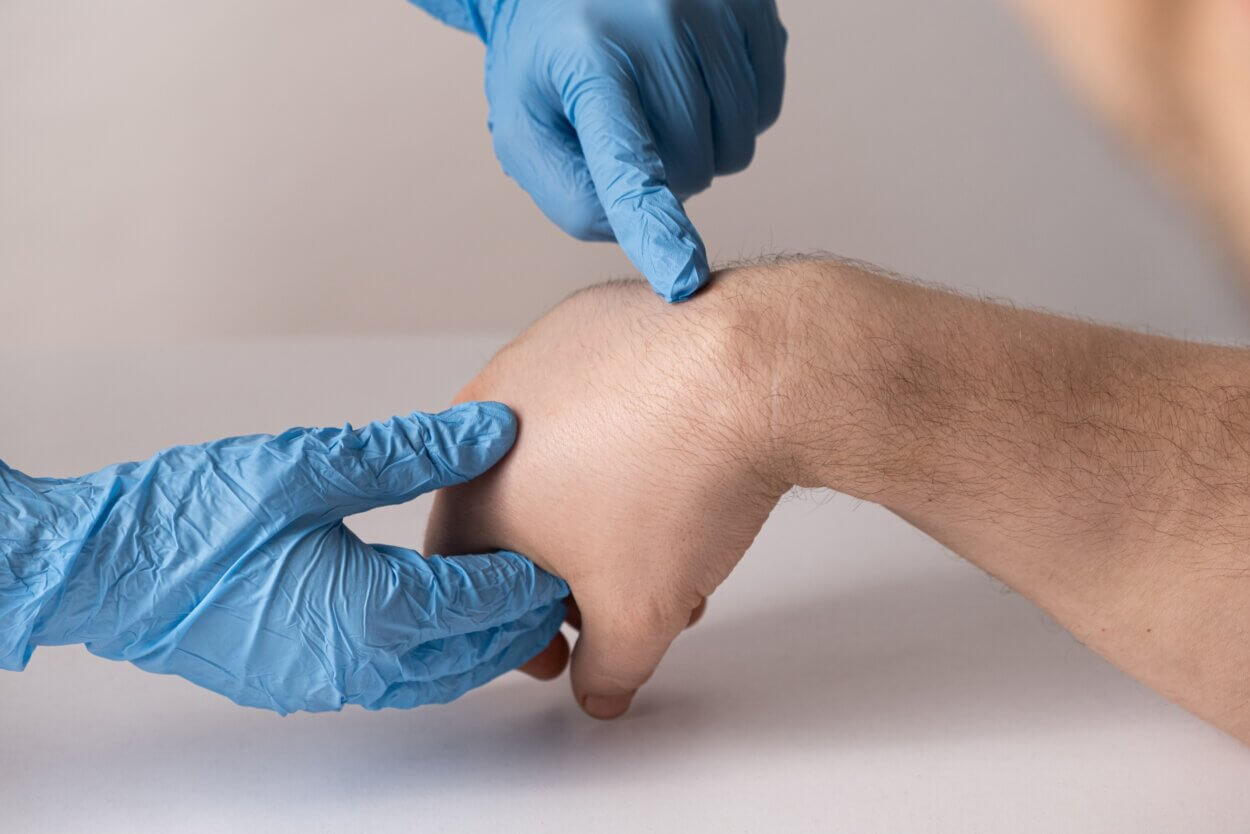 Ein typisches Ganglion