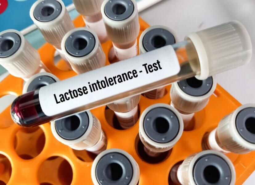 Test auf Laktoseintoleranz